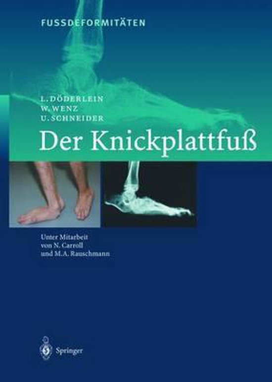 FussdeformitAeten, L. Döderlein | 9783642631573 | Boeken | bol