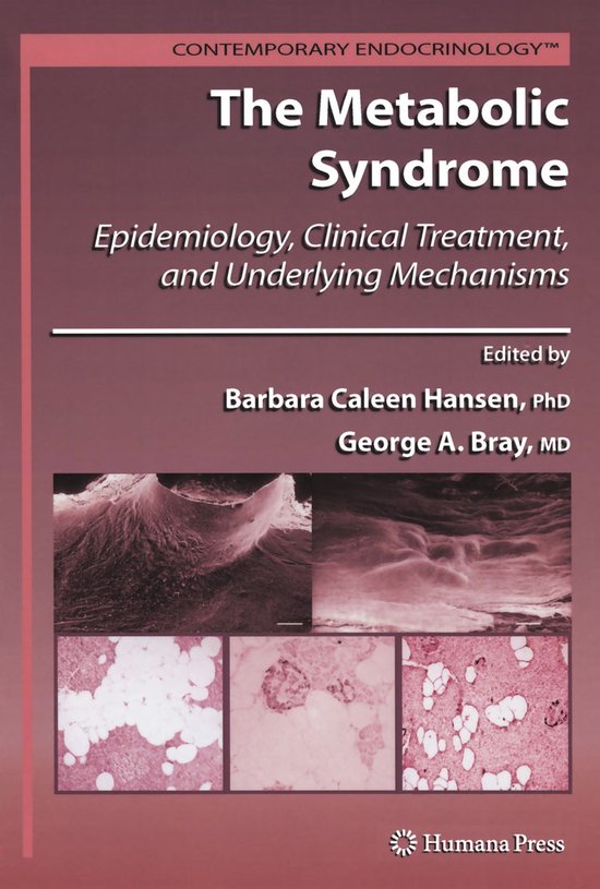 Boek 'The Metabolic Syndrome' met afbeeldingen van cellen en weefsels in roze en paarse tinten.