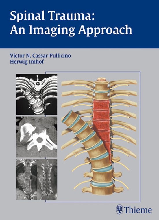 Spinal Trauma - An Imaging Approach - cover