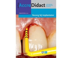 Omslag van AccreDidact TA2014-3 - Nazorg bij implantaten