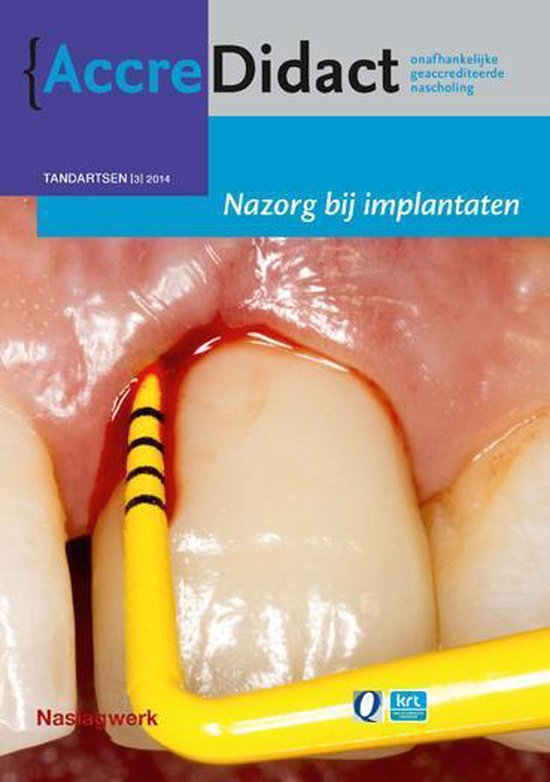 AccreDidact TA2014-3 - Nazorg bij implantaten