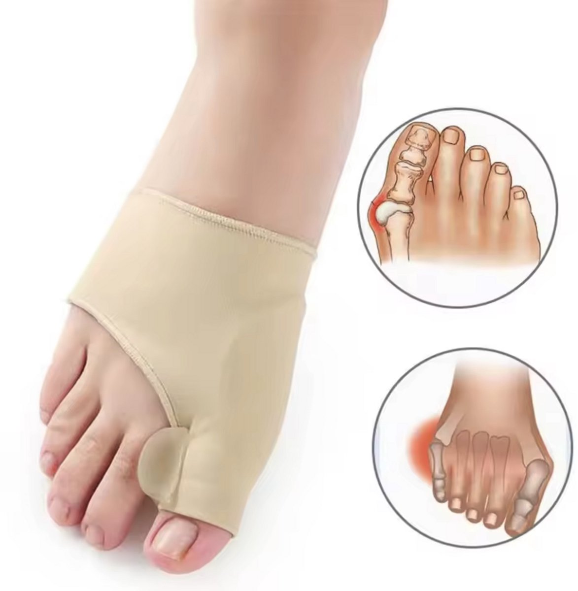 Hallux Valgus corrector - Teencorrector - Beige - 1 paar - Soft Gel Pad - One Size - Teenbeschermer - CHPN