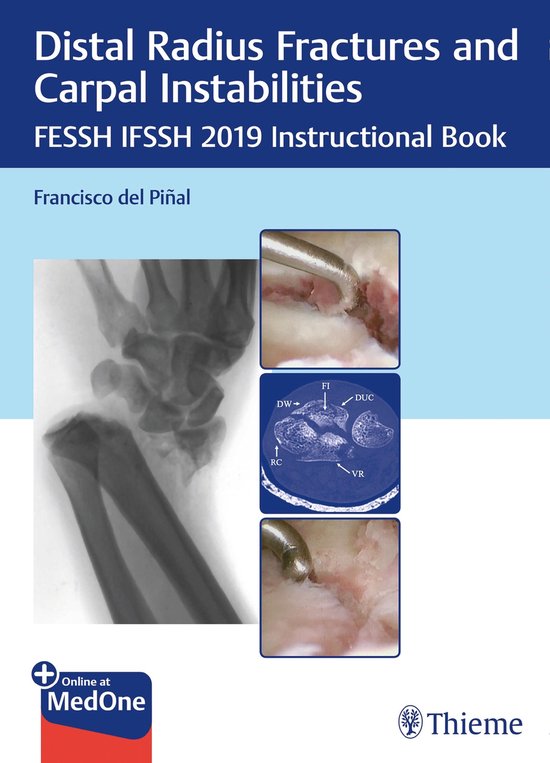 Distal Radius Fractures and Carpal Instabilities - cover