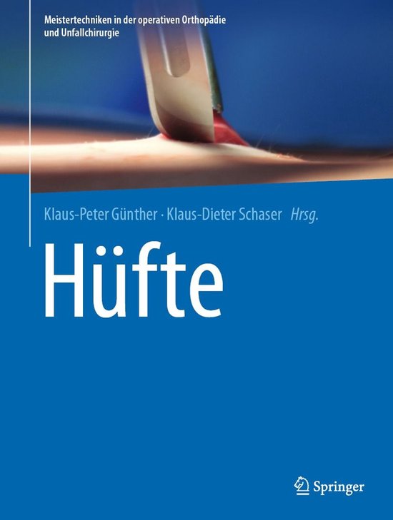 Meistertechniken in der operativen Orthopädie und Unfallchi ... - cover