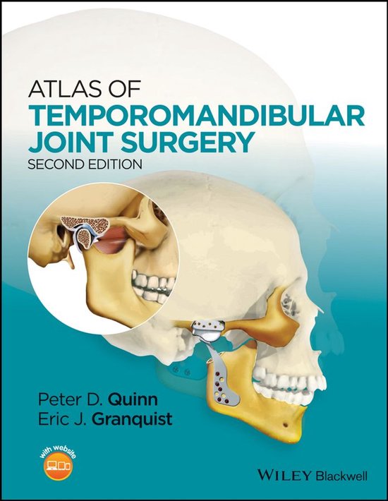 Atlas of Temporomandibular Joint Surgery - cover