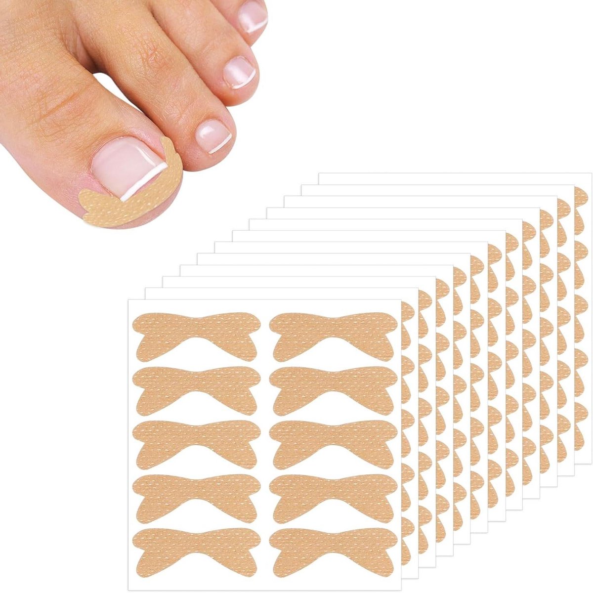 Cosensi - Teennagelpatch voor correctie van ingegroeide teennagels - 360 stuks