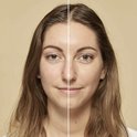 Vrouw met links onbehandelde huid en rechts de huid met L'Oréal Paris True Match foundation.