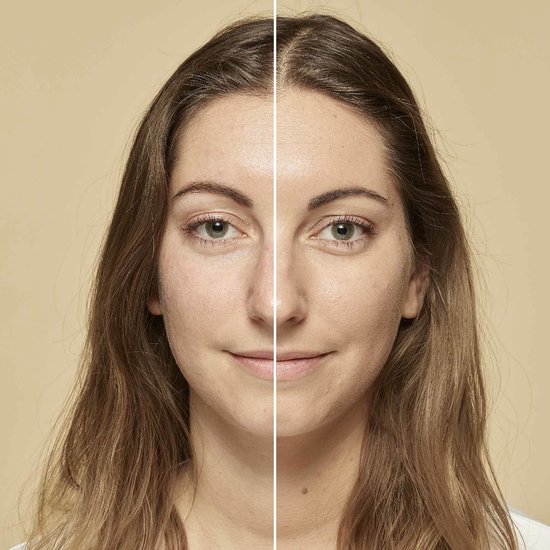 Vrouw met links onbehandelde huid en rechts de huid met L'Oréal Paris True Match foundation.