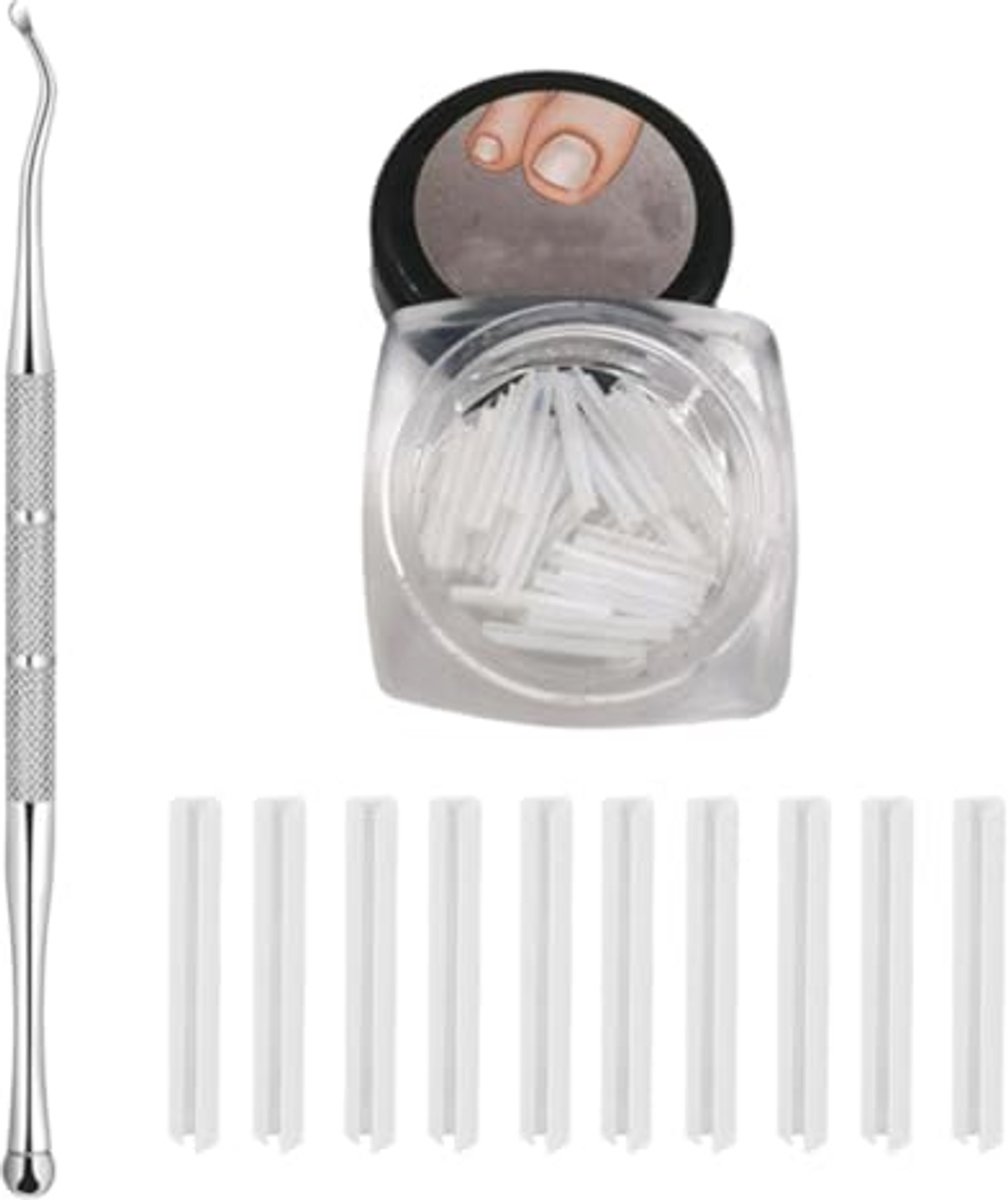 Set van 50 stuks voor het corrigeren van ingegroeide teennagels met pijnloze gladmakingsstrips en teennagellifter