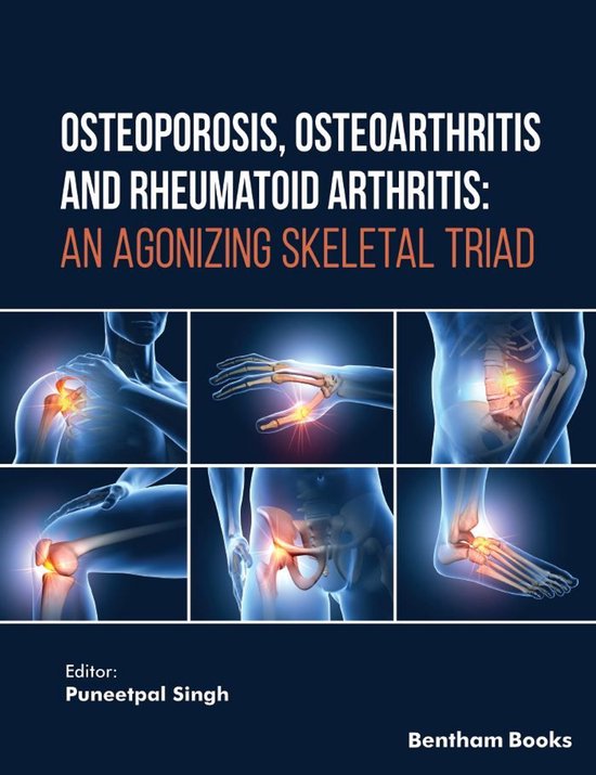 Osteoporosis, Osteoarthritis and Rheumatoid Arthritis: An Ag ... - cover