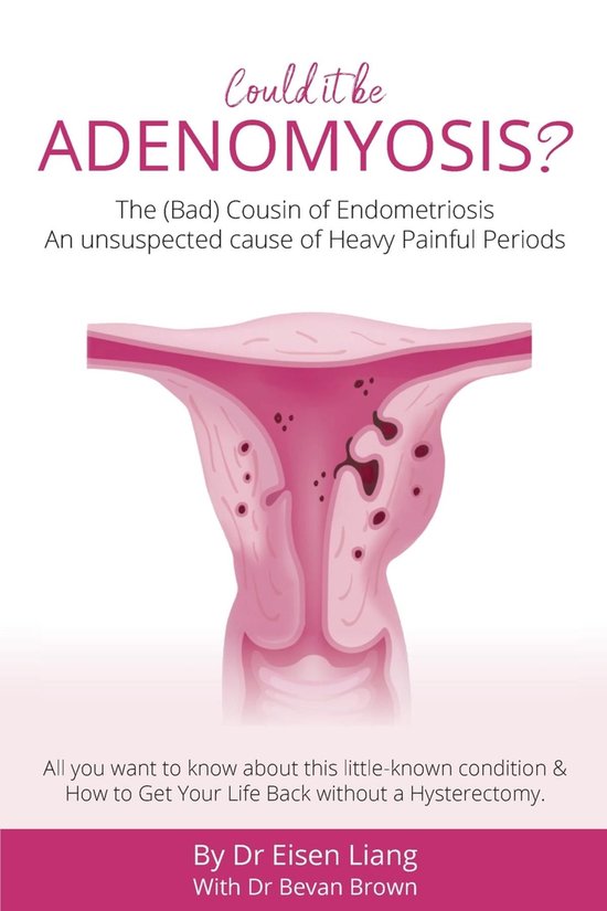 Adenomyosis -The Bad Cousin of Endometriosis - cover