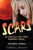 Scars