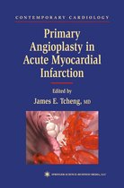 Contemporary Cardiology - Primary Angioplasty in Acute Myocardial Infarction