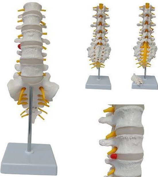 Het Menselijk Lichaam Anatomie Model Lumbale Wervelkolom En Heiligbeen Bol 1771