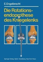 Die Rotationsendoprothese Des Kniegelenks