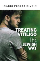 Treating Vitiligo