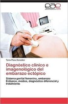 Diagnostico Clinico E Imagenologico del Embarazo Ectopico