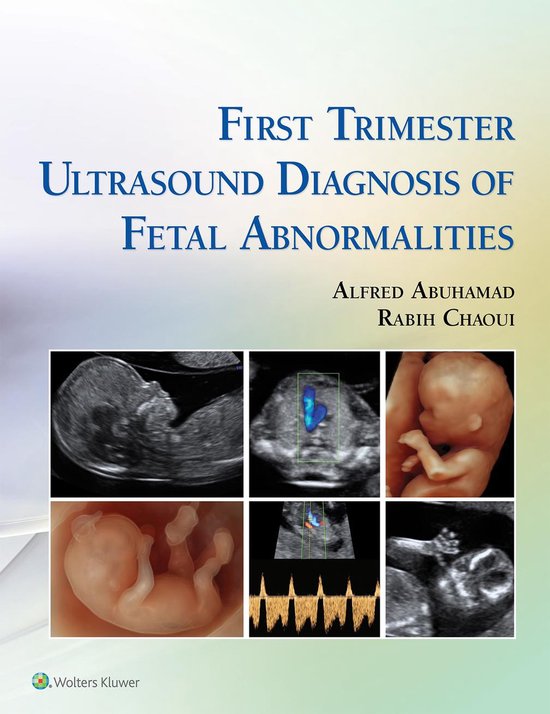 Foto: First trimester ultrasound diagnosis of fetal abnormalities