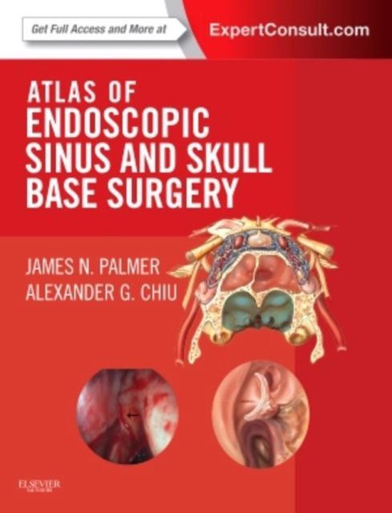 Atlas Of Endoscopic Sinus And Skull Base Surgery 9780323044080 James N Palmer 9628