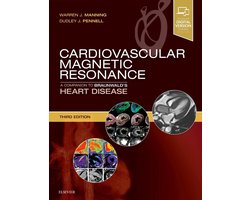 Cardiovascular Magnetic Resonance
