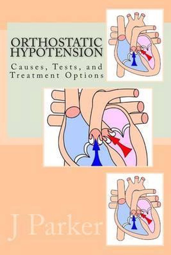Orthostatic Hypotension Causes, Tests, and Treatment Options, J M