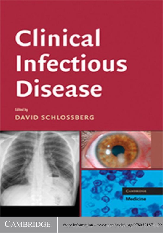 Clinical Infectious Disease (ebook) 9781139234979 Boeken