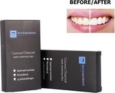 Whitening Strips Tandenbleekset voor Teeth Whitening- Teeth Whitener - Tanden Bleken - 100% Natuurlijk - Peroxidevrij - 14 Behandelingen