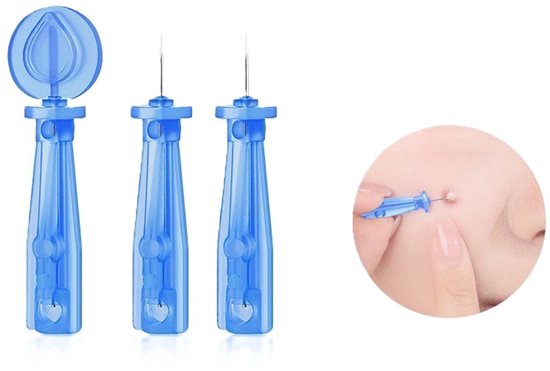 Drie blauwe comedonenverwijderaars, waarvan twee met naalden. Rechts een vergrote weergave van een naald die een puistje leegt.