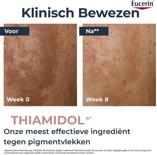 Twee foto's van een huid, 'Voor' (Week 0) met pigmentvlekken en 'Na' (Week 8) met minder vlekken. Tekst: "Klinisch Bewezen THIAMIDOL® Onze meest effectieve ingrediënten tegen pigmentvlekken".