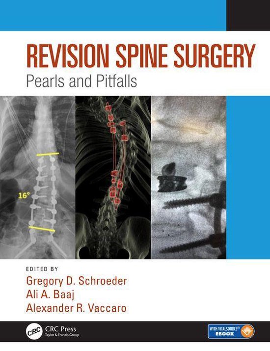 Revision Spine Surgery - cover
