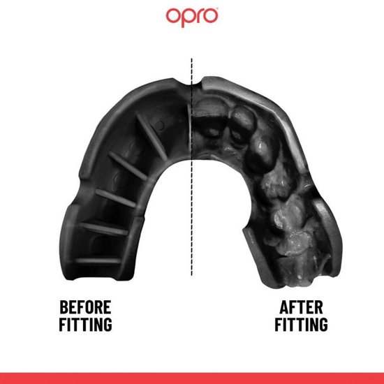 Zwarte Opro mondbeschermer voor en na het passen. 'Before fitting' en 'After fitting'.