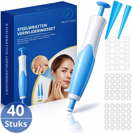 Doosje 'Steelwratjes Verwijderen Set 40 stuks' naast een applicator, opzetstukken en ringen.