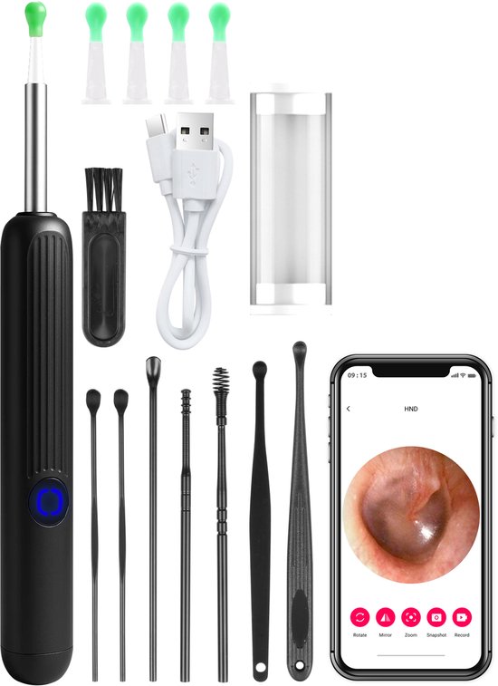 Nuvance Oorsmeer Verwijderaar met Camera App