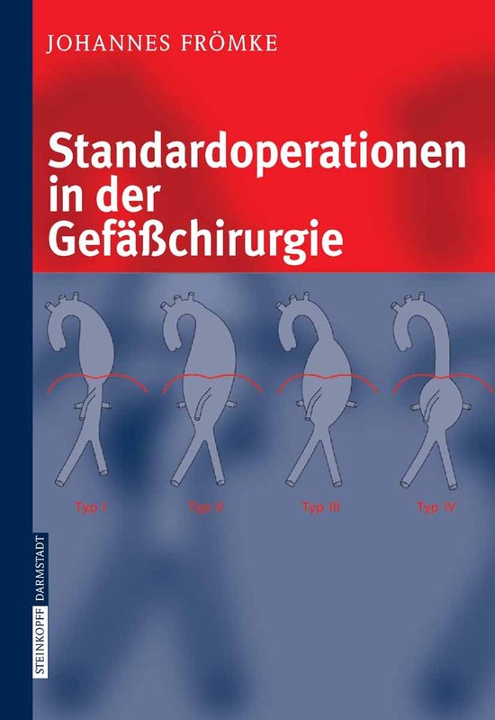Standardoperationen in Der Gefasschirurgie