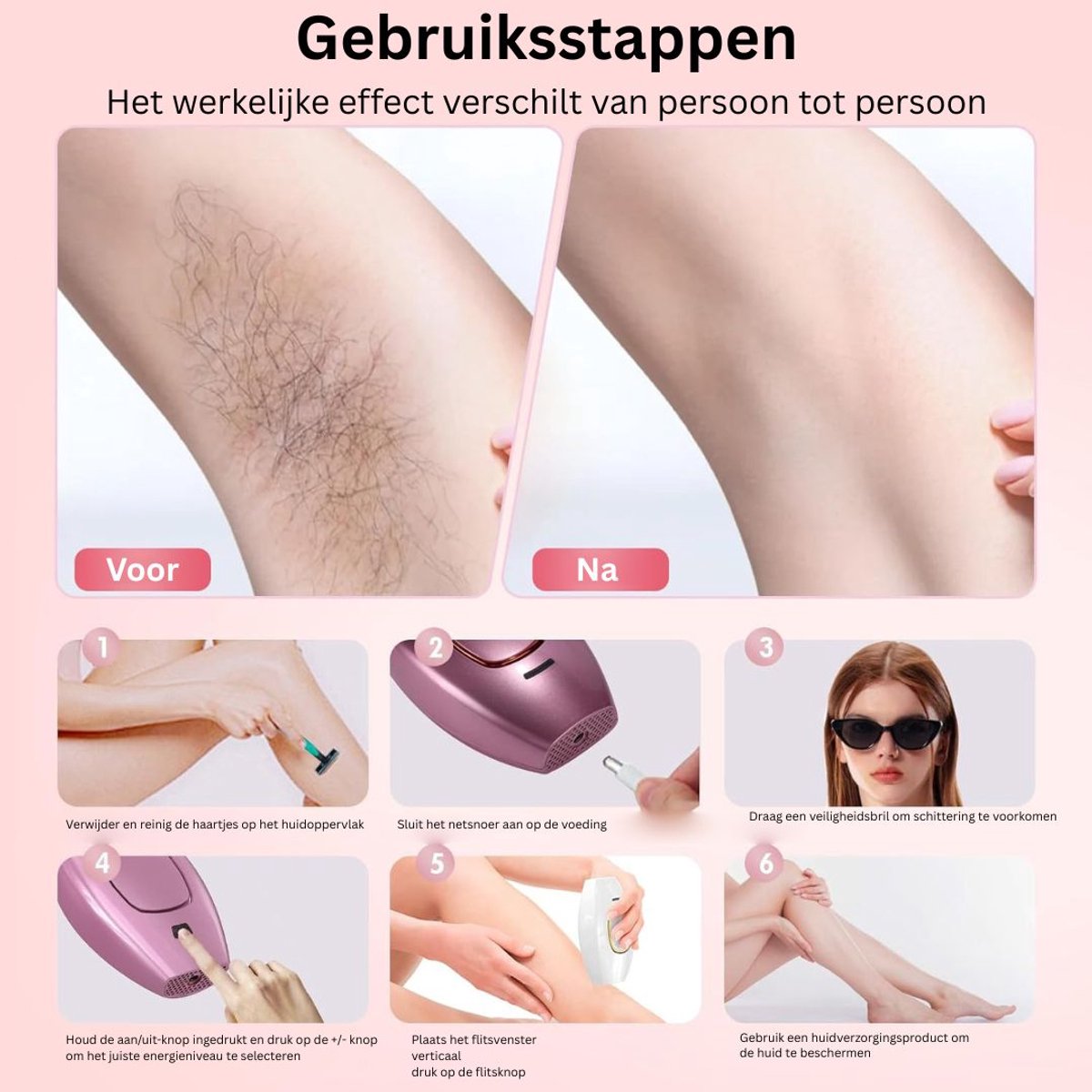 DailySupplies® Laser Ontharingsapparaat - IPL Ontharing - Mannen & Vrouwen thumbnail 4