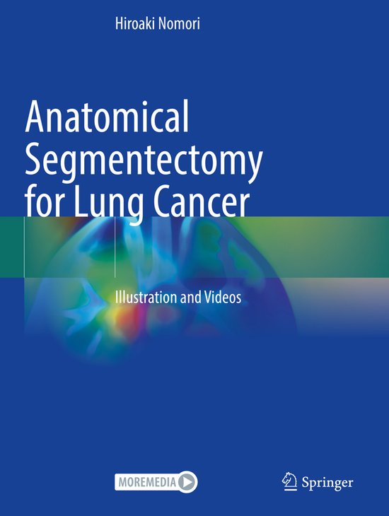 Anatomical Segmentectomy for Lung Cancer - cover