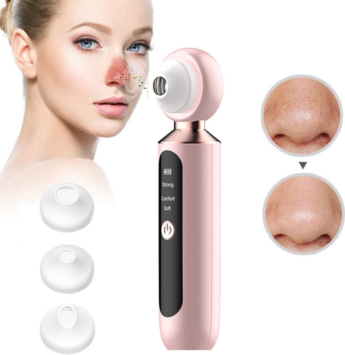 CHIWIN Poriënreiniger – Blackhead Remover met Vacuüm Technologie – 5 Modi – 3 Verwisselbare Opzetstukken – LED Verlichting en Vergrootglas – Roze