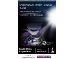 Small Incision Lenticule Extraction (SMILE): Surgical Technique and Challenges