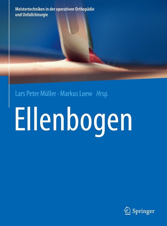 Meistertechniken in der operativen Orthopädie und Unfallchirurgie- Ellenbogen