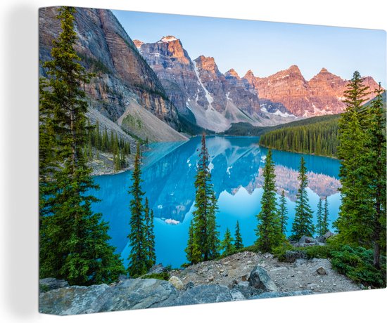 Canvas - Meer - Canada - Rocky Mountains - Landschap - Bos - Muurdecoratie - 150x100 cm - Interieur - Canvasdoek