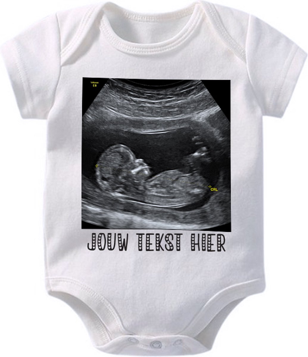 Hospitrix Baby Rompertje met je Eigen Echo Foto en Tekst | 0-3 maanden | Korte Mouw | Cadeau voor Zwangerschap | Bekendmaking | Aankondiging | Aanstaande Moeder | Moederdag