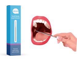MiBrush Amandelstenen Verwijderen - Tonsil stones verwijderaar voor stukjes, brokjes uit de keel