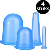 Cellulite Cups voor Cupping -  Anti Cellulitis Cupping set - Cupping Cups Cellulite Massage Apparaat Earkings - Blauw