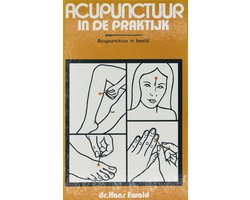 Acupunctuur in de praktijk