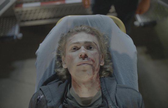 Jonge man met wonden en bloed op gezicht en nek, liggend op een brancard.