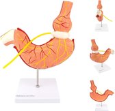 Het menselijk lichaam - anatomie model maag met maagband (2-delig, 26x21x7 cm)