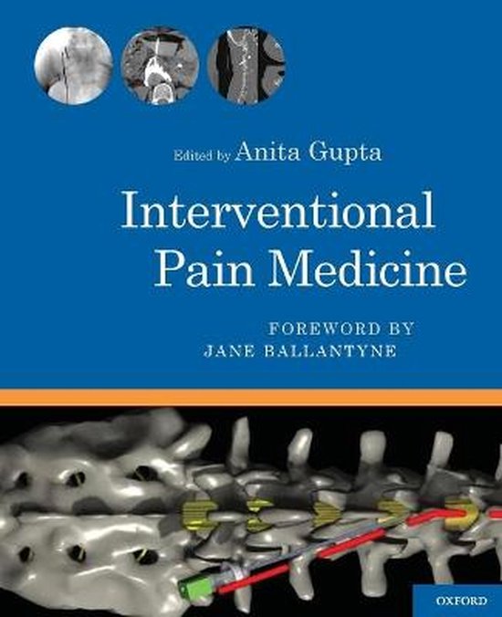 Interventional Pain Medicine 9780199740604 Gupta Boeken