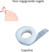 Copoline (gaze) pour les ongles incarnés (ou en prévention)