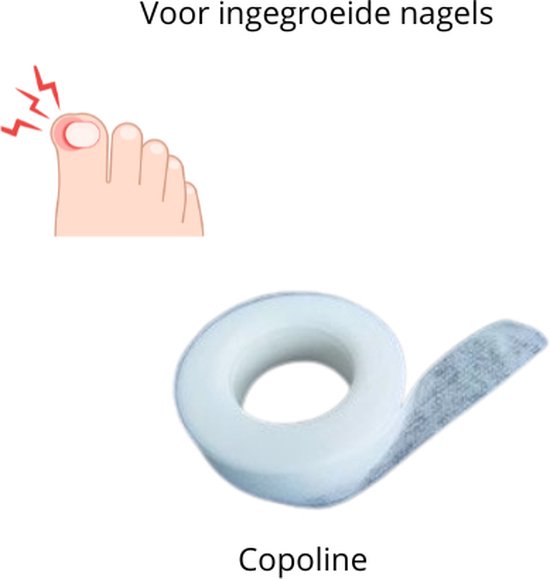 Copoline - Gaas - voor Ingegroeide Nagels - Voorkomt ingegroeide nagels