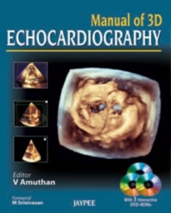 Manual of 3D Echocardiography | 9789350255865 | V Amuthan | Boeken ...